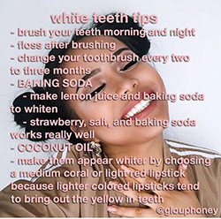 Your a queen you NEED the white teeth to nail your smile ?: 