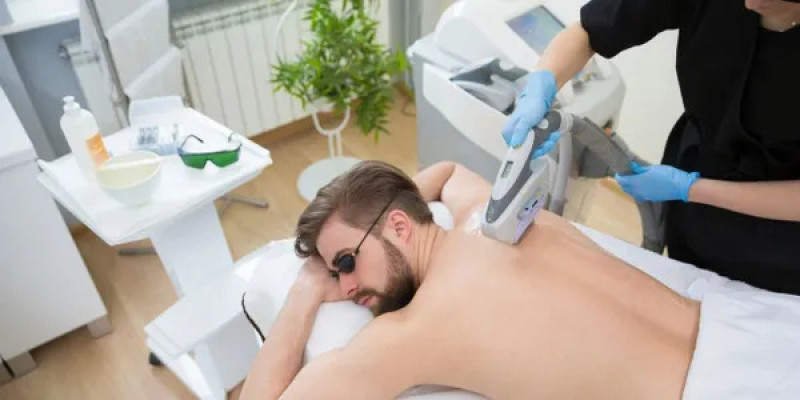Canton laser hair removal: 
