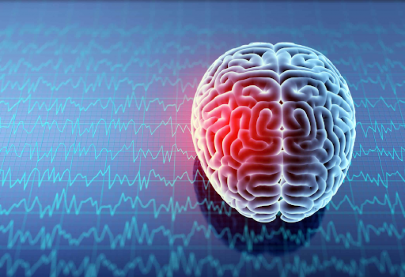 How to Choose the Right Los Angeles Brain Injury Attorney: 