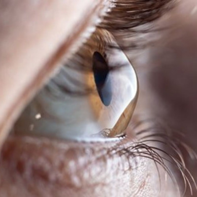 Harley Vision Laser Eye Clinic - Advanced Vision Laser Surgery with LASIK Precision: 