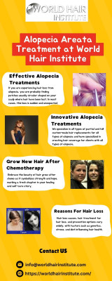 Alopecia Areata Treatment at World Hair Institute: 