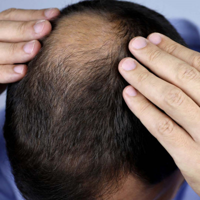 Expert Hair Care & Treatments | London Dermatology Clinics: 