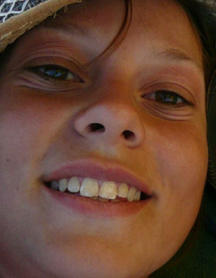 Aline Face: 