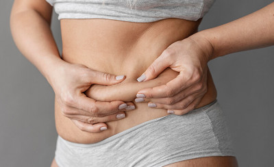 Tummy Tuck Surgery in Delhi - Dr. Lokesh Handa: 