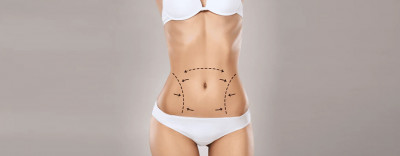 Drainless Tummy Tuck: What Is It and How Does It Compare to a Tummy Tuck with Drains - Dr. Lokesh Handa: 