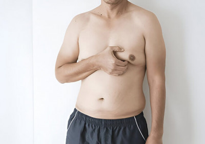 Gynecomastia Surgery in Delhi - Dr. Lokesh Handa: 
