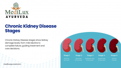 Chronic Kidney Disease Stages: 