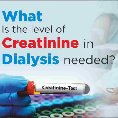 When to start dialysis creatinine level: 