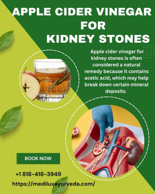 Apple Cider Vinegar For Kidney Stones: 
