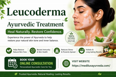 Leucoderma Ayurvedic Treatment | Natural Skin Care – MediLux Ayurveda: 