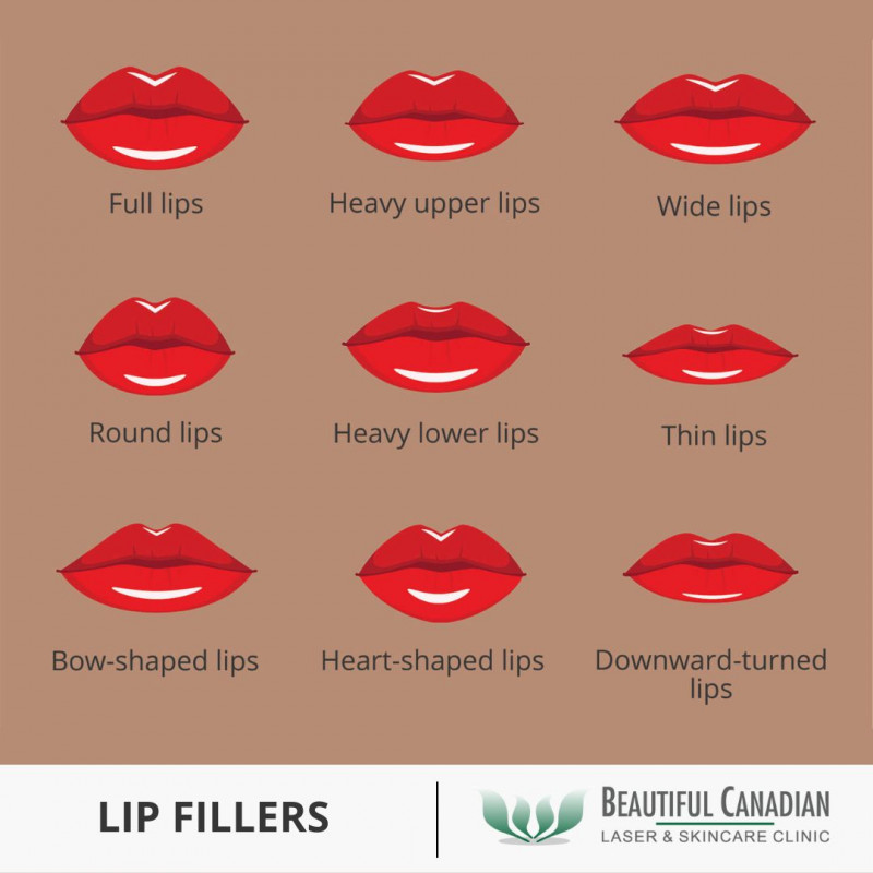 Lip fillers and lip injections - how they work