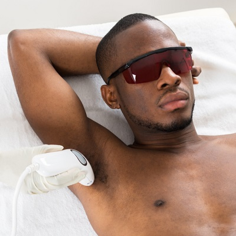 5 essential tips for laser hair removal: 