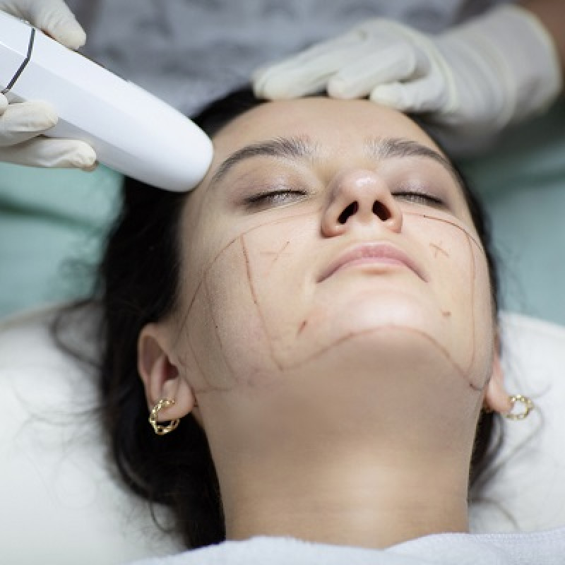 Hifu Treatment in Islamabad: 