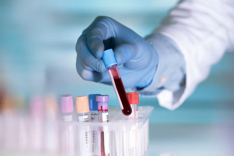 Fast & Reliable Drug Screening in Arlington, TX - Plano Drug Testing: 