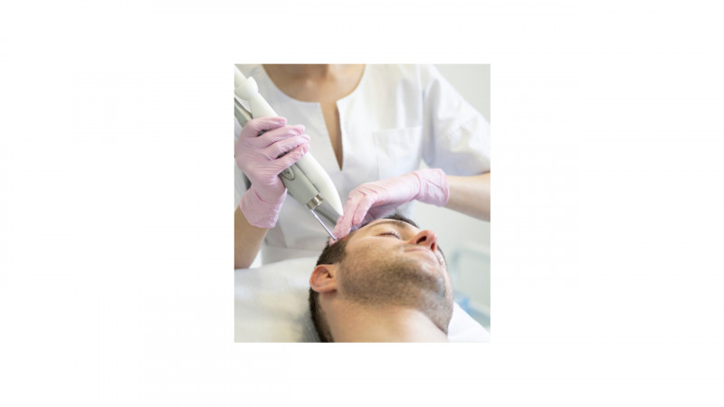 Hair Transplant Doctors in Delhi: 