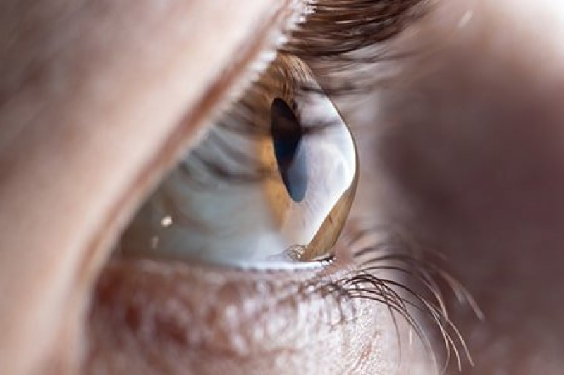 Trusted LASIK Eye Surgery in the UK | Harleyvision Specialists: 
