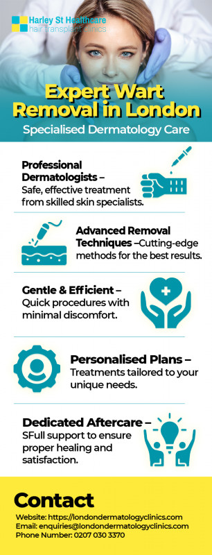 Expert Wart Removal in London – Specialised Dermatology Care: 