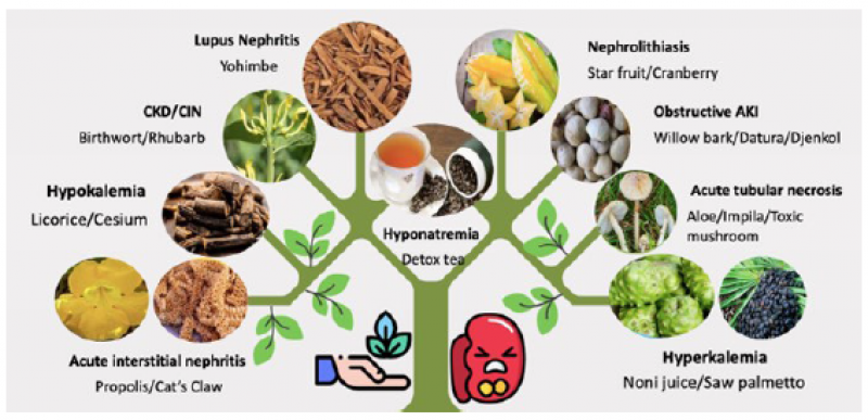 Natural Remedies for Kidney Failure: 