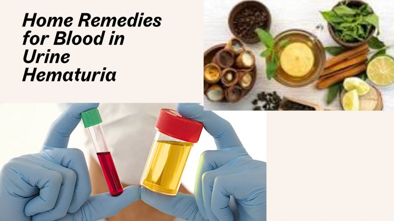 Home Remedies for Blood in Urine: 
