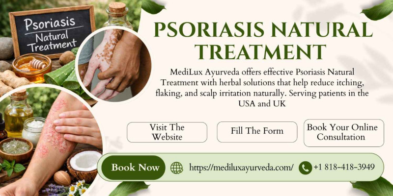 Psoriasis Natural Treatment | MediLux Ayurveda USA: 